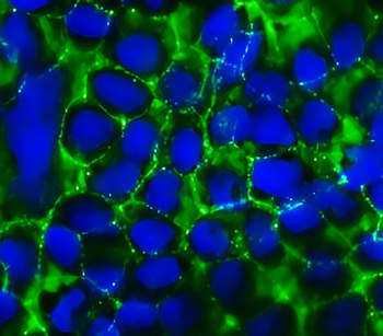 ZO-1 Rabbit Polyclonal Antibody