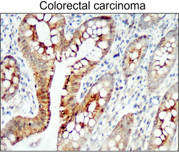 ZO-1 Rabbit Polyclonal Antibody