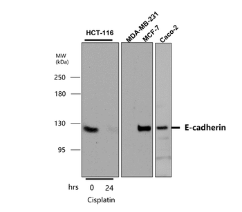 E-cadherin (Intracellular) Rabbit Polyclonal Antibody