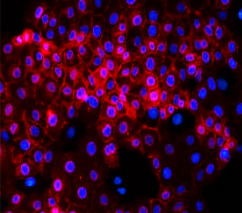E-cadherin (Intracellular) Rabbit Polyclonal Antibody