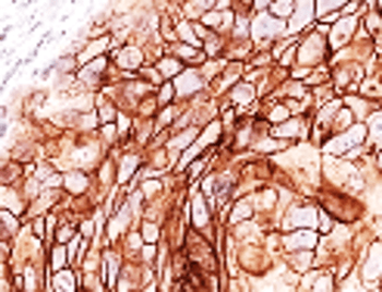 E-cadherin (Intracellular) Rabbit Polyclonal Antibody