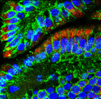 E-cadherin (Intracellular) Rabbit Polyclonal Antibody