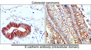 E-cadherin (Intracellular) Rabbit Polyclonal Antibody