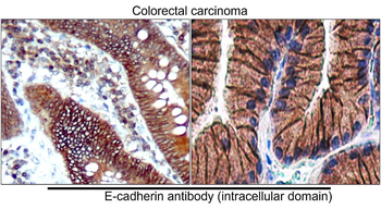 E-cadherin (Intracellular) Rabbit Polyclonal Antibody