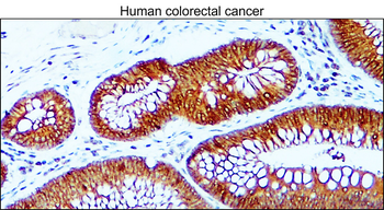 E-cadherin (Intracellular) Rabbit Polyclonal Antibody