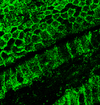 E-cadherin (Extracellular) Rabbit Polyclonal Antibody