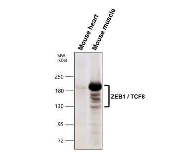 ZEB1 Rabbit Polyclonal Antibody