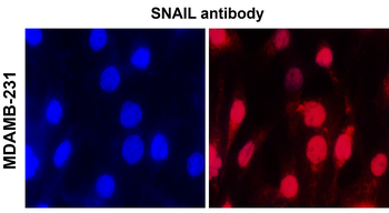 ZEB1 Rabbit Polyclonal Antibody