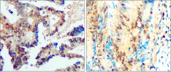 SNAIL Rabbit Polyclonal Antibody