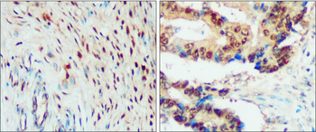 SNAIL Rabbit Polyclonal Antibody