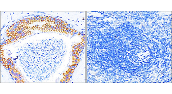 Beta-catenin Rabbit Polyclonal Antibody