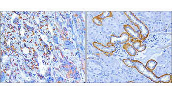 Beta-catenin Rabbit Polyclonal Antibody