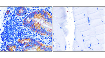 Beta-catenin Rabbit Polyclonal Antibody