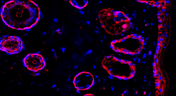 Beta-catenin Rabbit Polyclonal Antibody