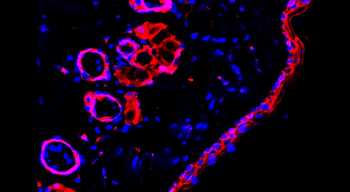 Beta-catenin Rabbit Polyclonal Antibody