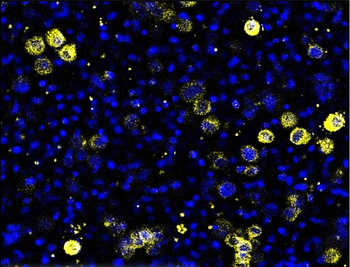 Beta-catenin Rabbit Polyclonal Antibody