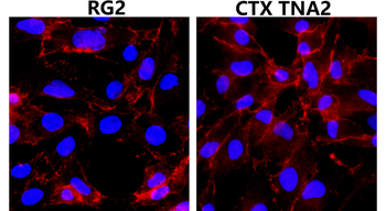 Beta-catenin Rabbit Polyclonal Antibody