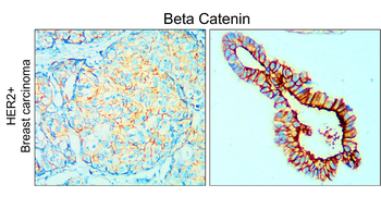 Beta-catenin Rabbit Polyclonal Antibody
