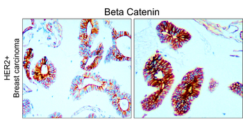 Beta-catenin Rabbit Polyclonal Antibody