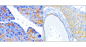 Beta-catenin Rabbit Polyclonal Antibody