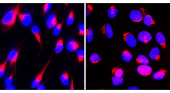 Fibronectin 1 Rabbit Polyclonal Antibody