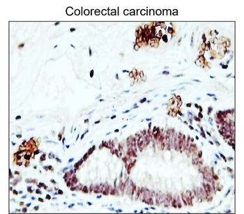 Fibronectin 1 Rabbit Polyclonal Antibody