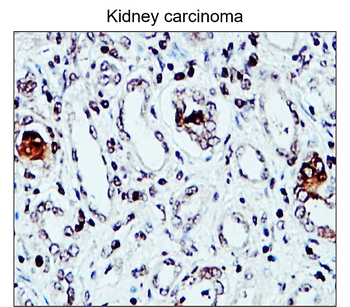 Fibronectin 1 Rabbit Polyclonal Antibody