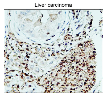 Fibronectin 1 Rabbit Polyclonal Antibody