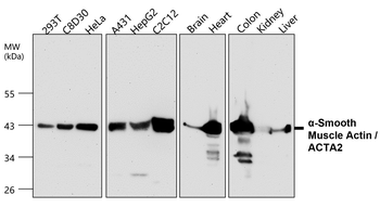 α-Smooth Muscle Actin Rabbit Polyclonal Antibody