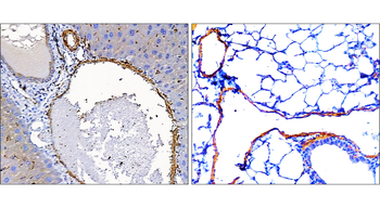 α-Smooth Muscle Actin Rabbit Polyclonal Antibody