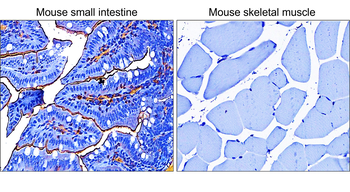 α-Smooth Muscle Actin Rabbit Polyclonal Antibody
