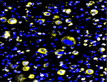 α-Smooth Muscle Actin Rabbit Polyclonal Antibody