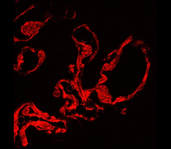 α-Smooth Muscle Actin Rabbit Polyclonal Antibody