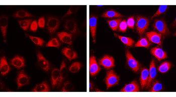 α-Smooth Muscle Actin Rabbit Polyclonal Antibody
