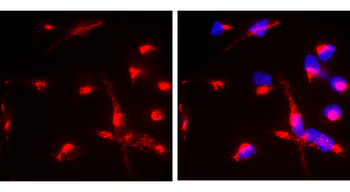 α-Smooth Muscle Actin Rabbit Polyclonal Antibody