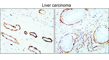 α-Smooth Muscle Actin Rabbit Polyclonal Antibody