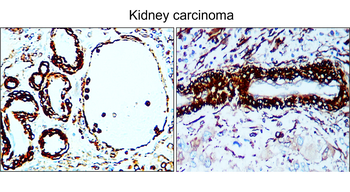 α-Smooth Muscle Actin Rabbit Polyclonal Antibody