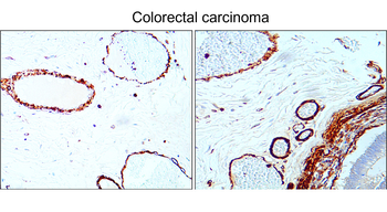 α-Smooth Muscle Actin Rabbit Polyclonal Antibody