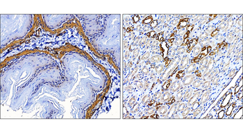 α-Smooth Muscle Actin Rabbit Polyclonal Antibody