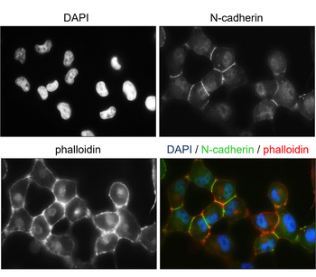 N-cadherin (Extracellular) Rabbit Polyclonal Antibody