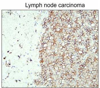 N-cadherin (Extracellular) Rabbit Polyclonal Antibody