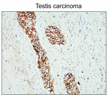 N-cadherin (Extracellular) Rabbit Polyclonal Antibody