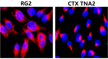 Vimentin Rabbit Polyclonal Antibody