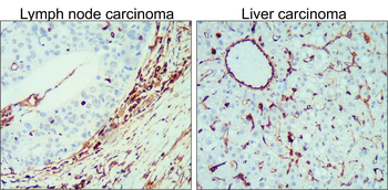 Vimentin Rabbit Polyclonal Antibody