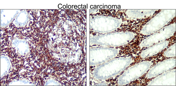 Vimentin Rabbit Polyclonal Antibody