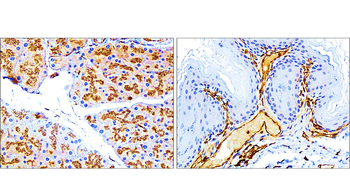 Vimentin Rabbit Polyclonal Antibody