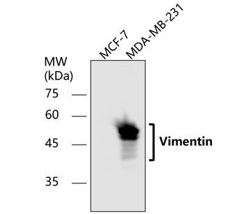 Vimentin Rabbit Polyclonal Antibody