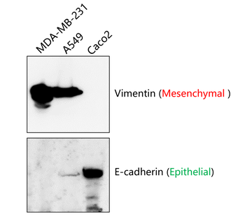Vimentin Rabbit Polyclonal Antibody