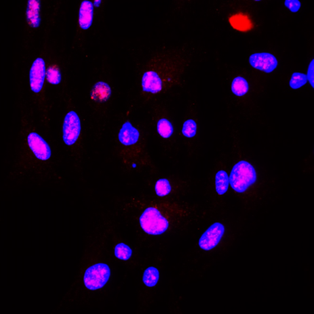 Alpha-synuclein Rabbit Polyclonal Antibody