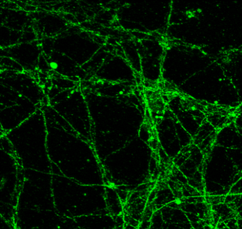 Alpha-synuclein Rabbit Polyclonal Antibody